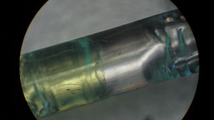 Fused joint.jpg